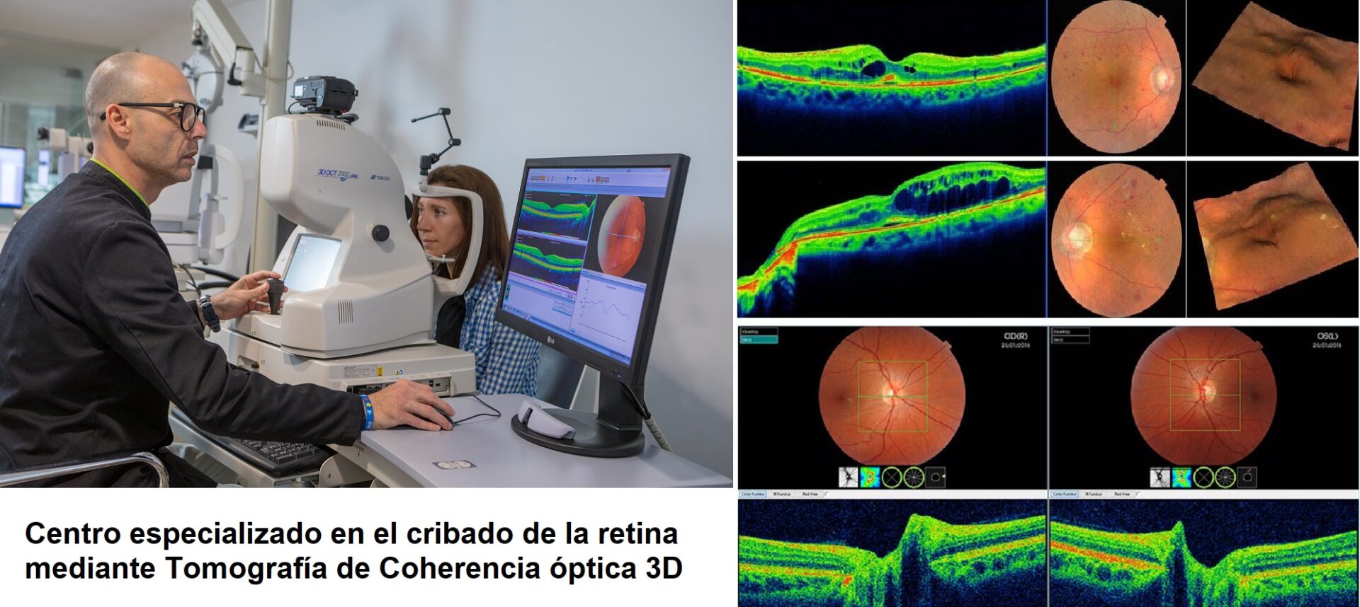 cribado-de-patologias-de-la-retina-Piedras-Blancas-Asturias