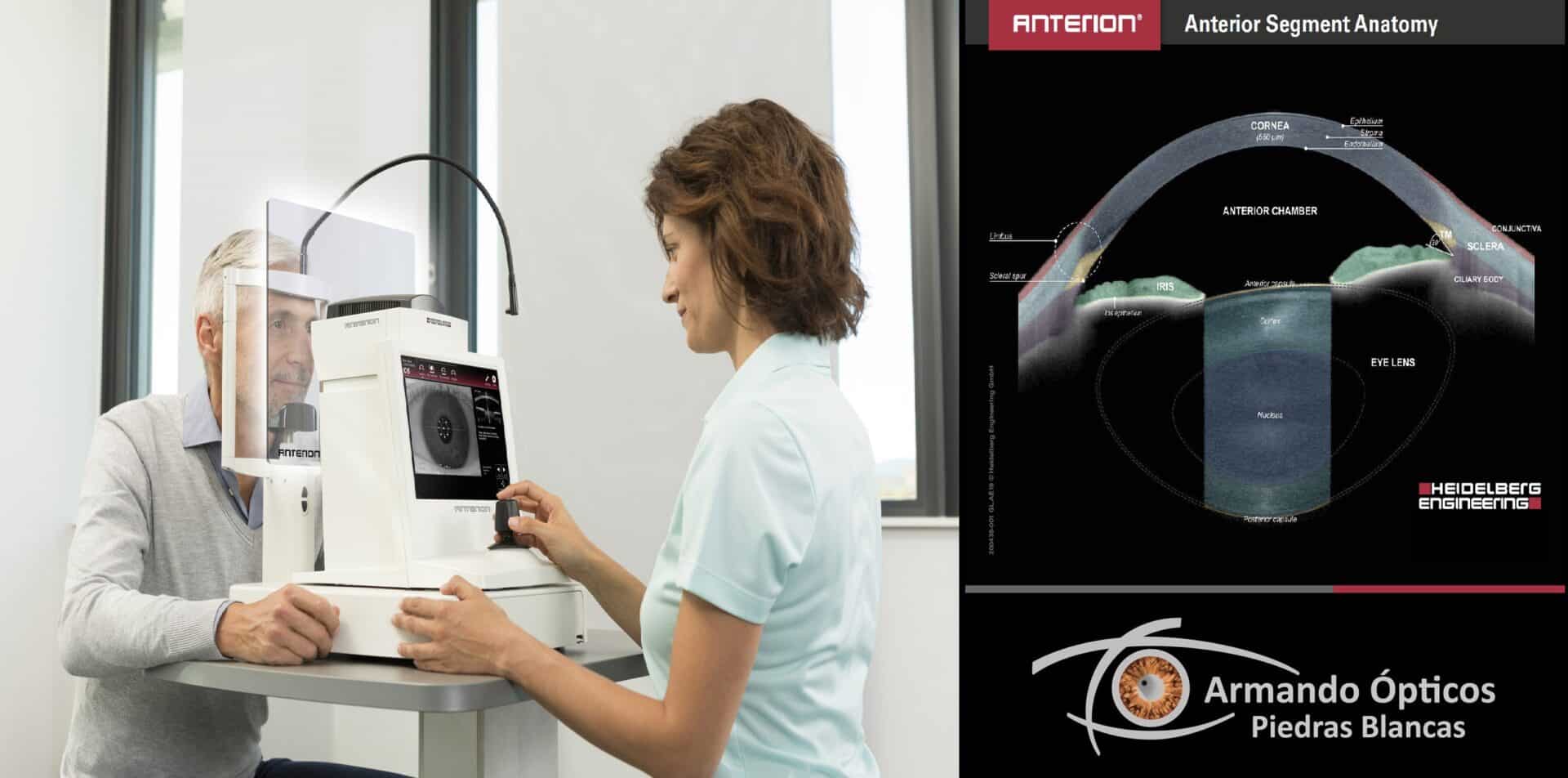 Lentillas esclerales Avilés, Gijón, Oviedo, Asturias